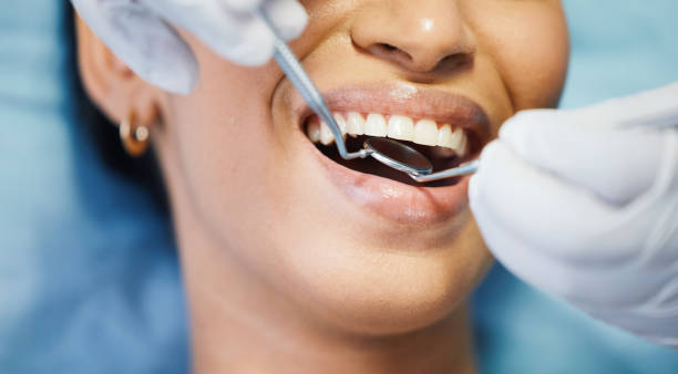 Best Lost Filling or Crown Replacement in Richwood, LA